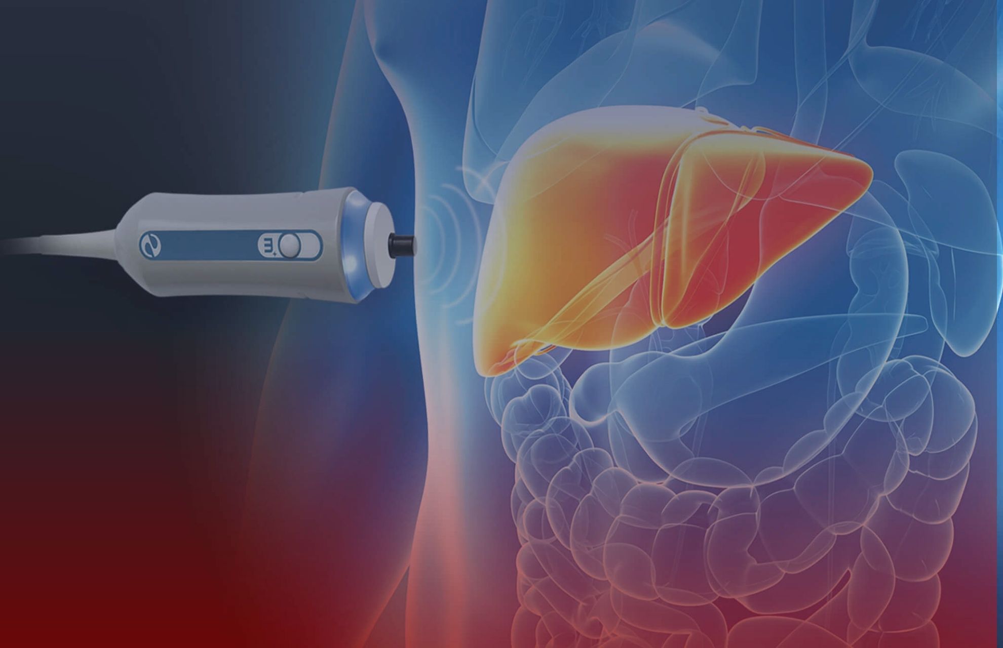 Fibroscan – Il nuovo passo per conoscere il fegato