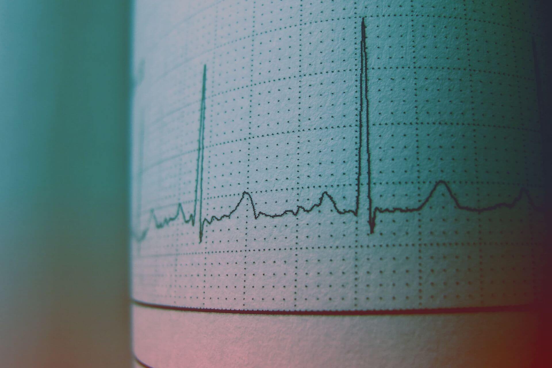 Cuore, batticuore o cuore matto